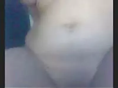 Jautri cutie pakliuvom į plaukuotą pūlingą.